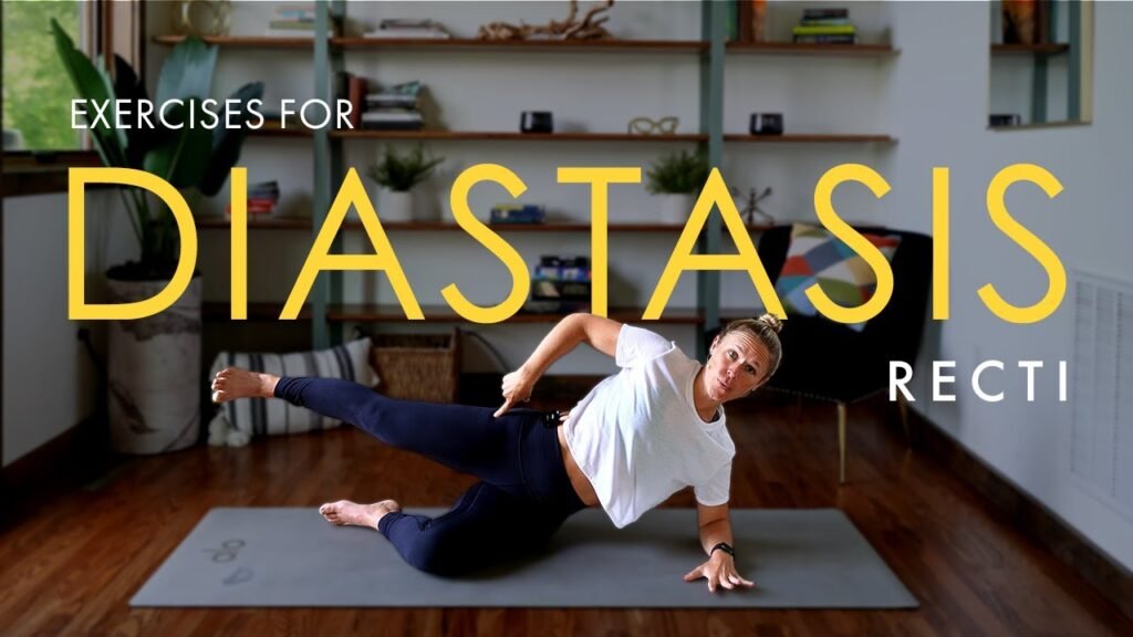 Diastasis Recti Exercises: Strengthen Your Core and Support Recovery