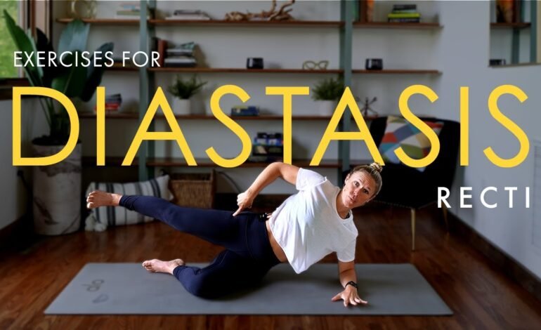 Diastasis Recti Exercises: Strengthen Your Core and Support Recovery