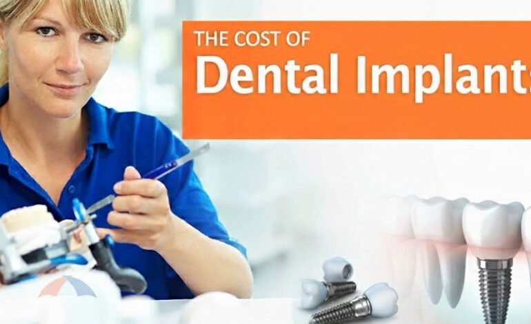 How Much Dental Implants Cost and Why They Are Expensive
