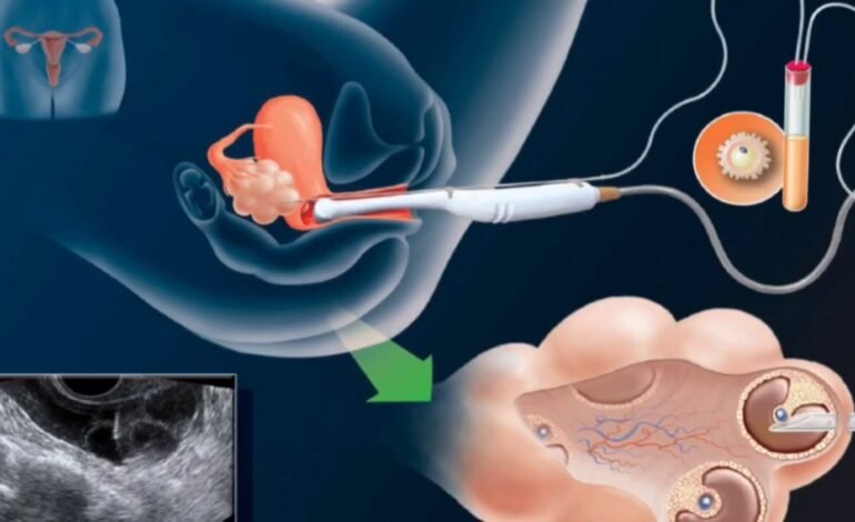 Make Your Dream of Motherhood Come True with Artificial Insemination