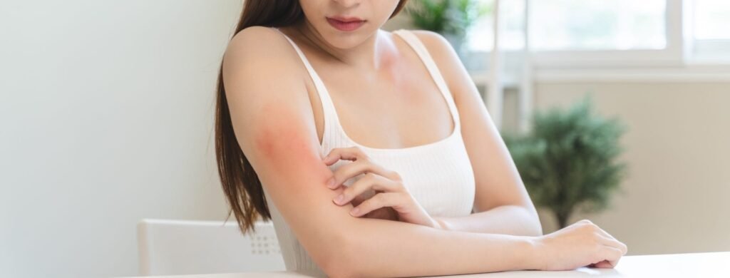 Skin allergy problems causing redness, itching, rashes, and irritated skin due to an allergic reaction.