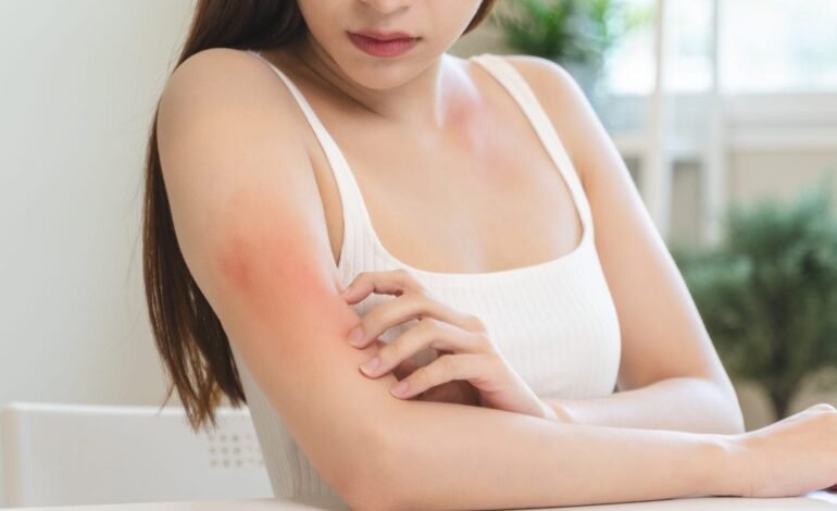 Skin Allergy Problems: Early Signs You Should Never Ignore